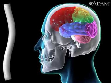 cartoonhd concussion|Concussions animation .